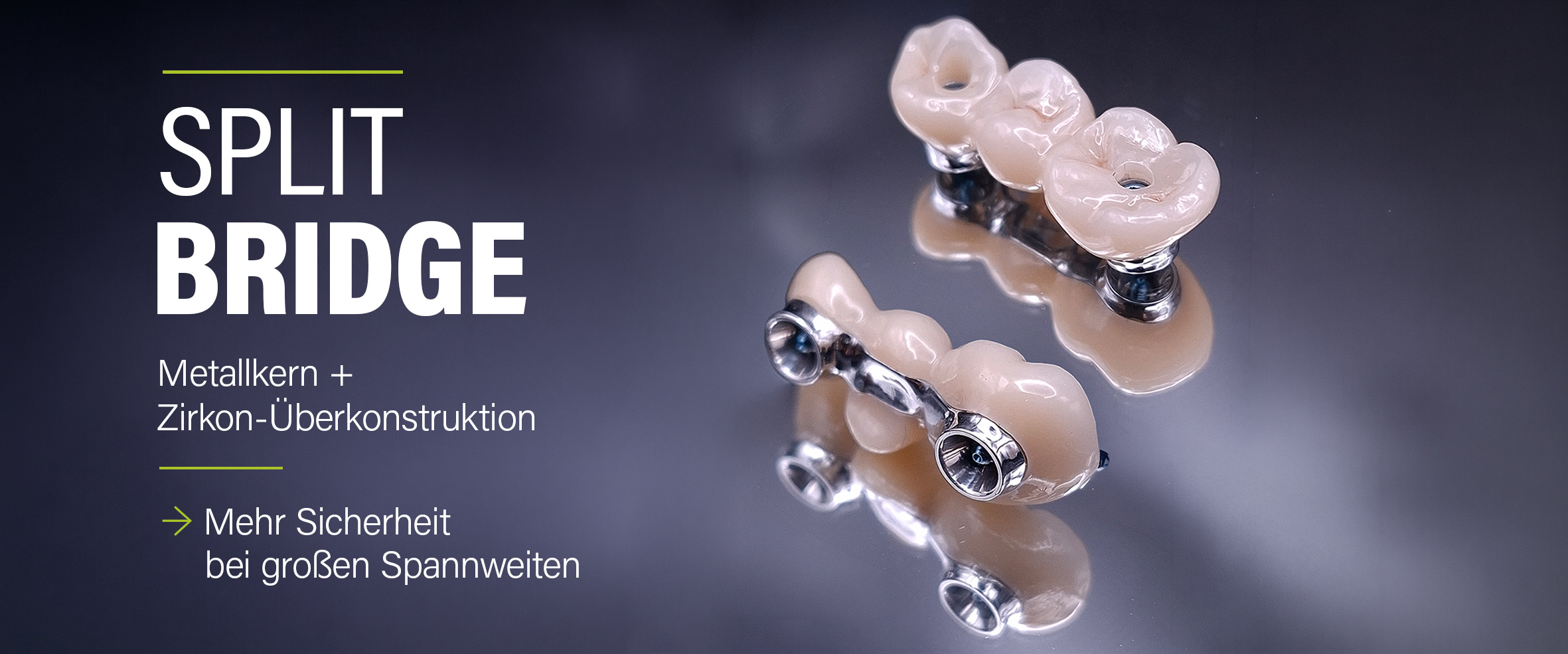 Motiv einer Split-Bridge mit kurzer Erklärung: Metallkern + Zirkon-Überkonstruktion, mehr Sicherheit bei großen Spannweiten.